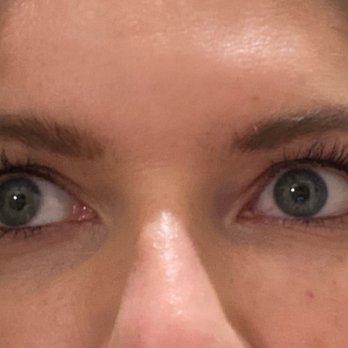 Andre Aboolian - Under eye filler - Cosmetic Surgeons Near Me - Beverly Hills, California