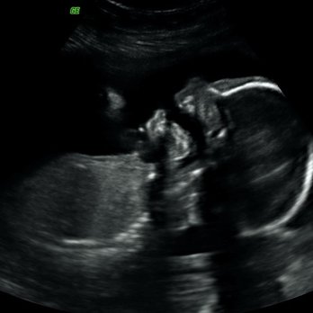 TrueView Ultrasound - Ultrasound Imaging Centers Near Me - Roseville , California TrueView Ultrasound - Ultrasound Imaging Centers Near Me - Roseville , California