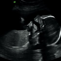TrueView Ultrasound