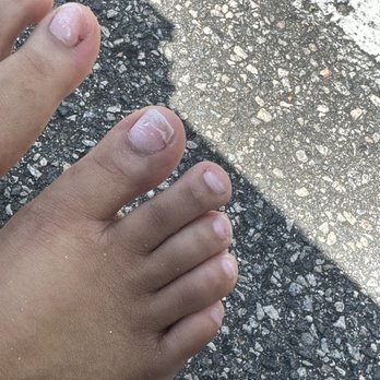 Happy Nails & Spa - damaged toe nails - Nail Salons Near Me - Chesapeake, Virginia Happy Nails & Spa - damaged toe nails - Nail Salons Near Me - Chesapeake, Virginia