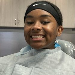Vanguard Orthodontics - Fulton - After