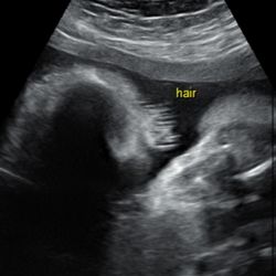 A Future Look 3D4D Ultrasound And Photography