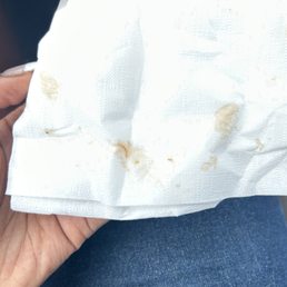 The nail that was inside my Honey BBQ wing. The nail that was inside my Honey BBQ wing.