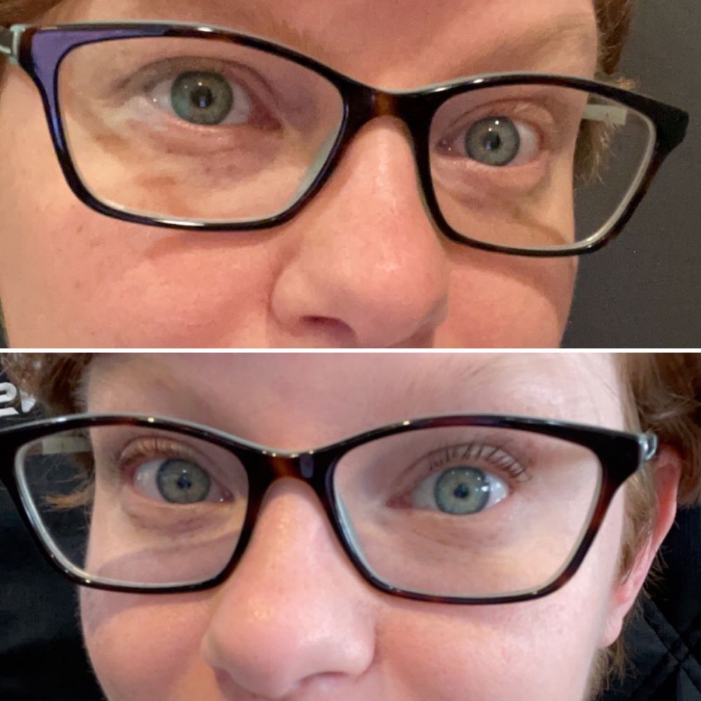 Pure Excellence Esthetics Logo