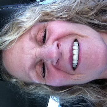 Posh Dental - My new crowns! - General Dentistry Near Me - Temecula, California