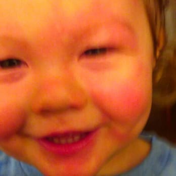 Zankou Chicken - My 17 month old in Anaphylaxis after eating Zankous Chicken. - Mediterranean Near Me - Montebello, California Zankou Chicken - My 17 month old in Anaphylaxis after eating Zankous Chicken. - Mediterranean Near Me - Montebello, California