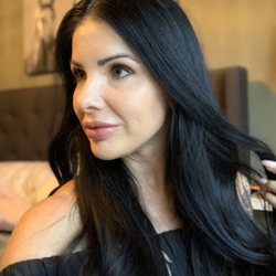 Kylas Esthetics & Laser - Microneedling for youthful gorgeous skin!