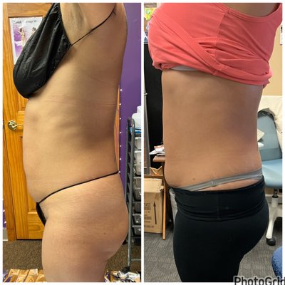 Body Contouring by J