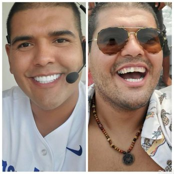 Brite Smile Dental - Before & After - Cosmetic Dentists Near Me - San Diego, California