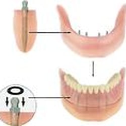 John S Keadle, DDS