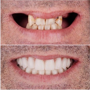 Boulevard Dental - Call us to see how we can help you - General Dentistry Near Me - Palmdale, California