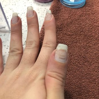Instyle Nail Spa - Damaged nails caused by Steve over filing my nails down in the middle - Nail Salons Near Me - Boca Raton, Florida Instyle Nail Spa - Damaged nails caused by Steve over filing my nails down in the middle - Nail Salons Near Me - Boca Raton, Florida