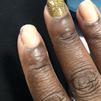 Orchid Nail Spa - Day 5 Thumb nail completely gone now other nails all chipped - Nail Salons Near Me - Norfolk, Virginia