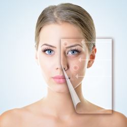 All Beauty Laser clinic & spa - Active acne and Acne scars treatment