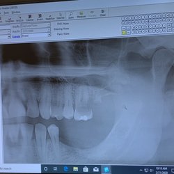 Affordable Dentures & Implants - Disaster area