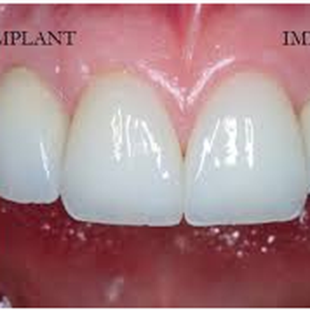 Aura Dental - General Dentistry Near Me - Houston, Texas