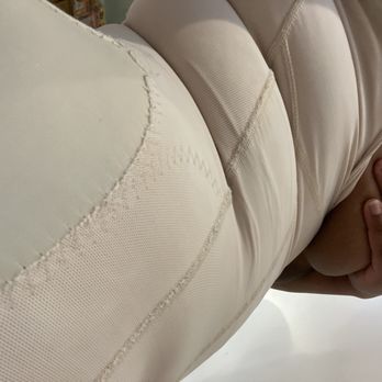 Miami Life Cosmetic Center - My side my back still big - Plastic Surgeons Near Me - Miami, Florida Miami Life Cosmetic Center - My side my back still big - Plastic Surgeons Near Me - Miami, Florida