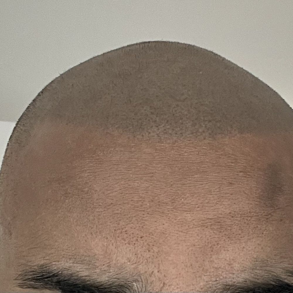 After After