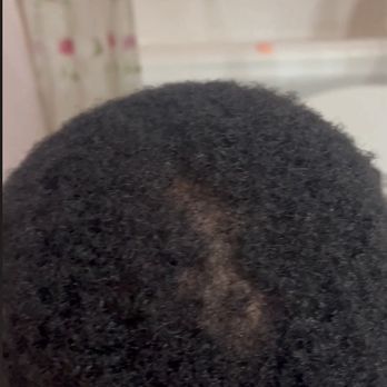 Da Barbershop - 2-3 inch bald spot after getting haircut here. - Barbers Near Me - San Jose, California