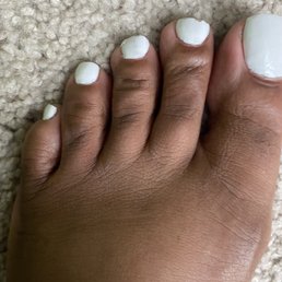 Saturday afternoon pedicure looks like this Monday morning. Saturday afternoon pedicure looks like this Monday morning.