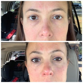 Tina's Permanent Makeup and Eyelash - Before and after pictures of my permanent eyeliner. Tina did a great job. Headed back for my two month touch next month! - Permanent Makeup Near Me - Cypress, Texas Tina's Permanent Makeup and Eyelash - Before and after pictures of my permanent eyeliner. Tina did a great job. Headed back for my two month touch next month! - Permanent Makeup Near Me - Cypress, Texas