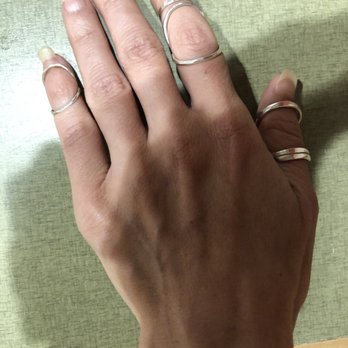 MGH Physical Therapy - My custom, silver ring splints for connective tissue disorder... Game changers! - Physical Therapy Near Me - Boston, Massachusetts MGH Physical Therapy - My custom, silver ring splints for connective tissue disorder... Game changers! - Physical Therapy Near Me - Boston, Massachusetts