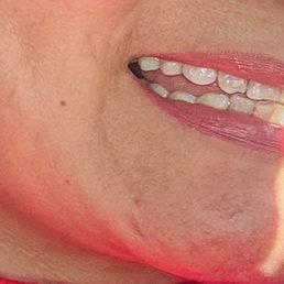 My new smile My new smile