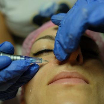 Sapphire Elite Spa - Microneedling - Skin Care Near Me - East Brunswick, New Jersey Sapphire Elite Spa - Microneedling - Skin Care Near Me - East Brunswick, New Jersey