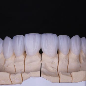 Sm4 Smile Method For All - SM4 smile lab Veneers - Cosmetic Dentists Near Me - Tijuana, BCN