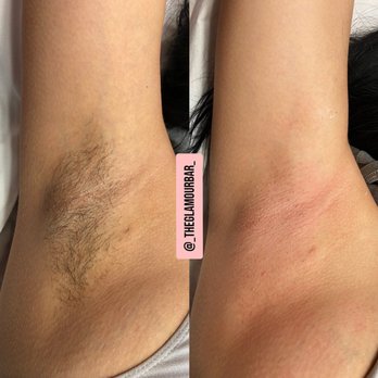 The Glamour Bar - B&A of so smooth underarms - Sugaring Near Me - Corona, California The Glamour Bar - B&A of so smooth underarms - Sugaring Near Me - Corona, California