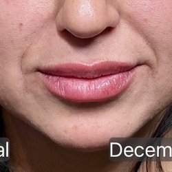 JMarie Skin Studio - After
