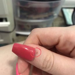 Cut on Cuticle Pt. 2 Cut on Cuticle Pt. 2