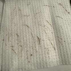 Refreshed Esthetics - Build up of 2-3 weeks of dead skin cells and peach fuzz. The results are amazing!!