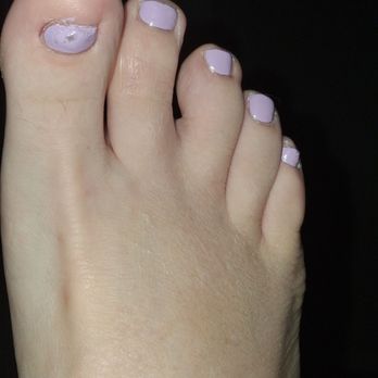Ex Nail - Pardon my big toe. The nail is growing. - Nail Salons Near Me - Indianapolis, Indiana
