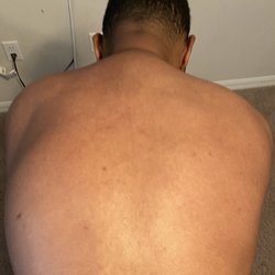 Ben Kermani, MD - Upper left back pain.