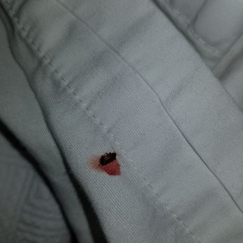 Crowne Plaza Edison - Huge bed bug 2. That's my blood it ate while I slept. - Hotels Near Me - Edison, New Jersey