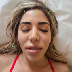 Longevity Acupuncture - Reduce tension in the head and jaws