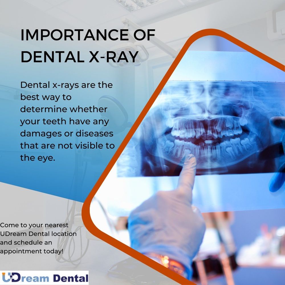 UDREAM DENTAL FULLERTON Updated September 2024 98 Photos & 83