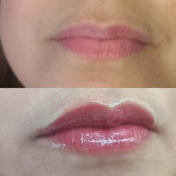 Las Bella Reinas - Lip Blush procedure. Before & After.