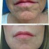 Frontier Dermatology Aesthetics gift card