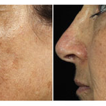 Keller Med Spa & Laser - Medical Spas Near Me - Camas, Washington Keller Med Spa & Laser - Medical Spas Near Me - Camas, Washington