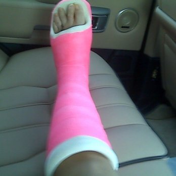 SCOS Orthopedic Specialists - Post-op surgery left foot, ankle, etc. Dr. Michael Brage (Ortho Foot/Ankle Specialist) previously at SCOS in Laguna Woods, CA. - Orthopedists Near Me - Laguna Woods, California