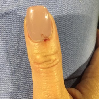 J B Nails - I had a cut and bled after I had a fill in acrylic. 2 more of my fingers had a cut too. Not coming back here ever - Nail Salons Near Me - Long Beach, California J B Nails - I had a cut and bled after I had a fill in acrylic. 2 more of my fingers had a cut too. Not coming back here ever - Nail Salons Near Me - Long Beach, California