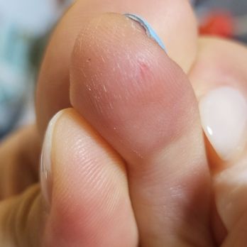 Bui808 Nails - Scratched up skin on my toes - Nail Salons Near Me - Kapolei, Hawaii
