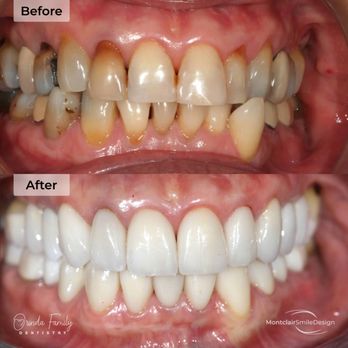 Montclair Smile Design - General Dentistry Near Me - Oakland, California