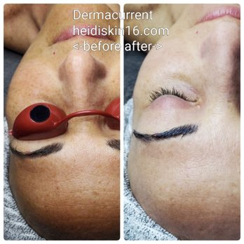 SKIN16 - Looking for Brightening your skin? Come to get facial Dermacurrent or Dermalight - Skin Care Near Me - San Francisco, California SKIN16 - Looking for Brightening your skin? Come to get facial Dermacurrent or Dermalight - Skin Care Near Me - San Francisco, California