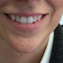 Aesthetic Laser Center - Before.