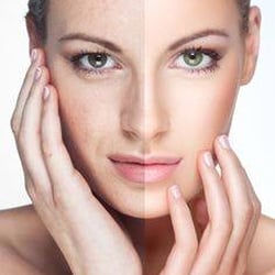 Alchemy Wellness Studio - Beautiful Skin