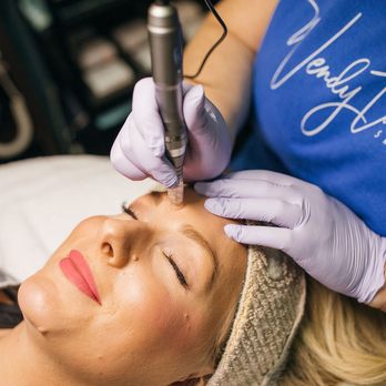 Saving Face Skinspa - Microneedling demo - Acne Treatment Near Me - Olympia, Washington