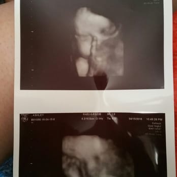 Babes & Bellies - Ultrasound Imaging Centers Near Me - Long Beach, California
